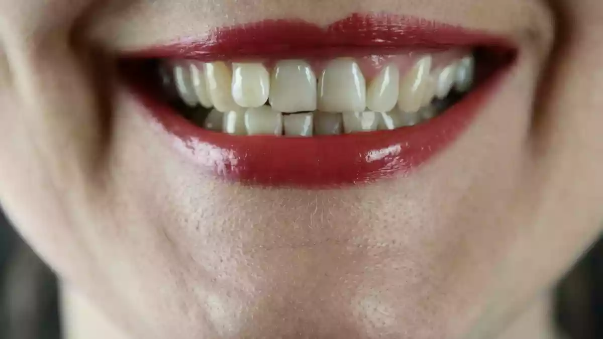 भारत में दांतों की इनेमल कमजोर होने की समस्या तेजी से बढ़ रही है, जिसका मुख्य कारण कुछ आम गलतियां हैं जैसे जोर से ब्रश करना, एसिडिक और चीनी वाली डाइट, कम पानी पीना आदि. आज किसी भी