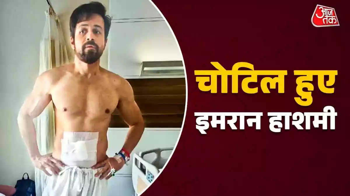 आवारापन 2' के दौरान चोटिल हुए इमरान हाशमी