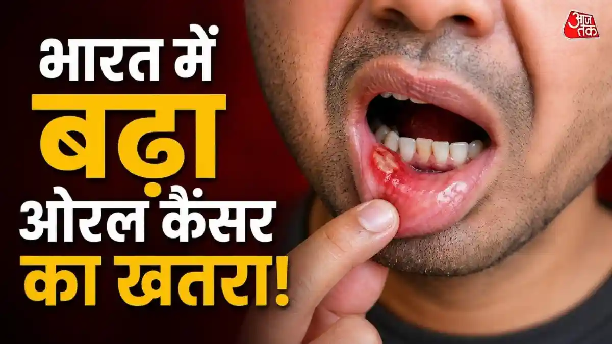भारत में क्यों बढ़ रहा ओरल कैंसर
