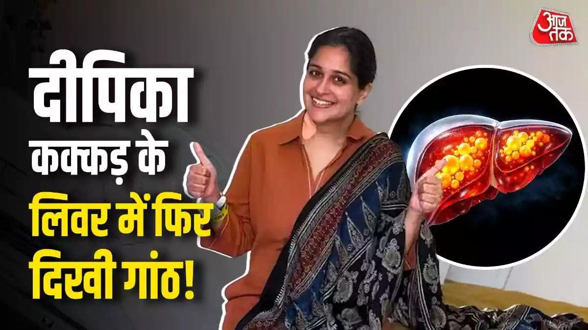 एक्ट्रेस दीपिका कक्कड़ इन दिनों अपनी सेहत को लेकर काफी परेशान हैं. हाल ही में आए स्कैन में उनके लिवर में दोबारा सिस्ट (गांठ) दिखने की बात सामने आई है. लिवर सिस्ट क्या होता है और यह दोबारा