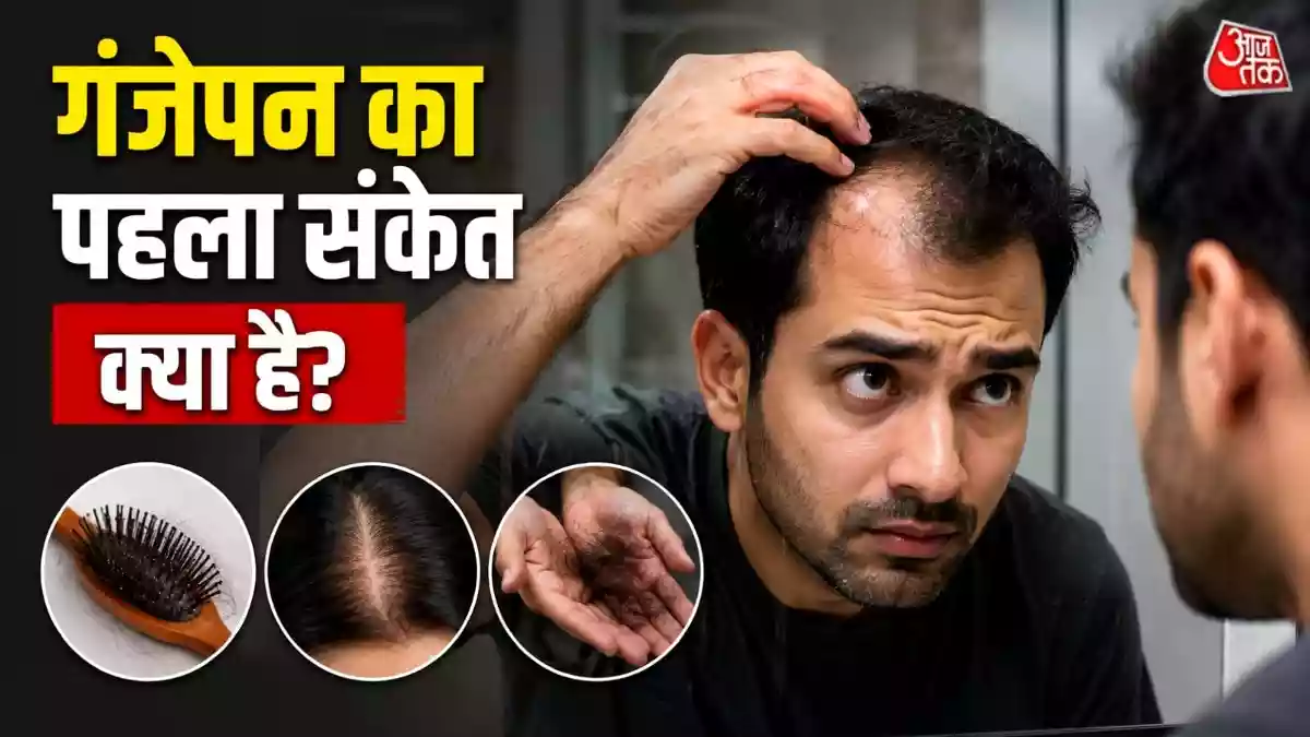हेयर फॉल का पहला संकेत क्या है