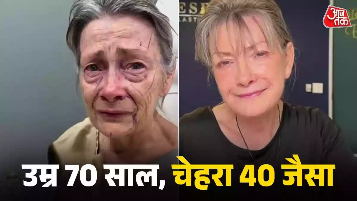 झुर्रियां गायब