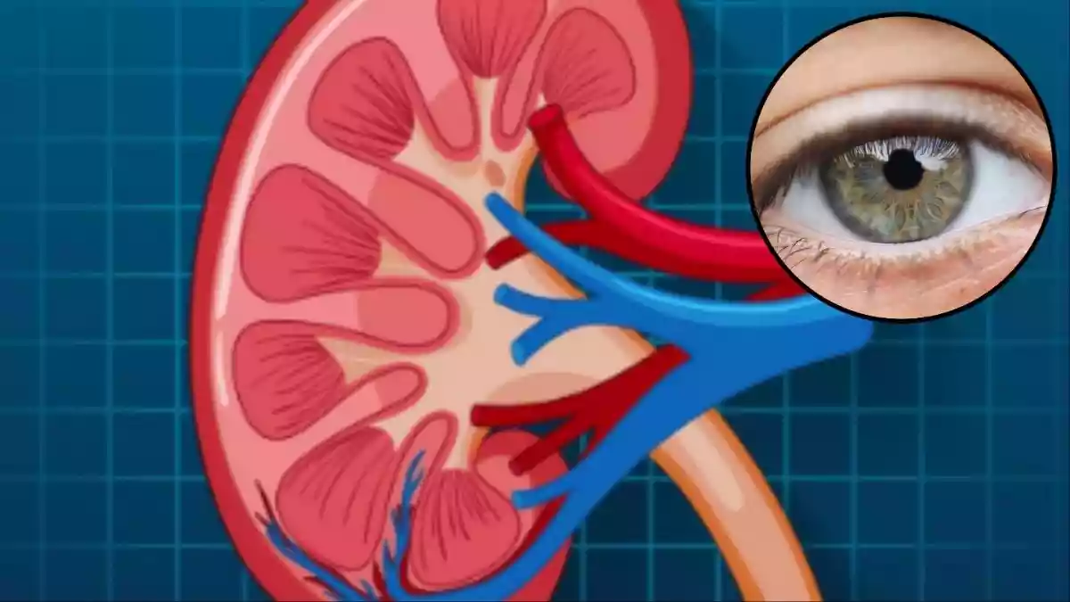 किडनी खराब होने पर आंखों में दिखते हैं ये 4 संकेत