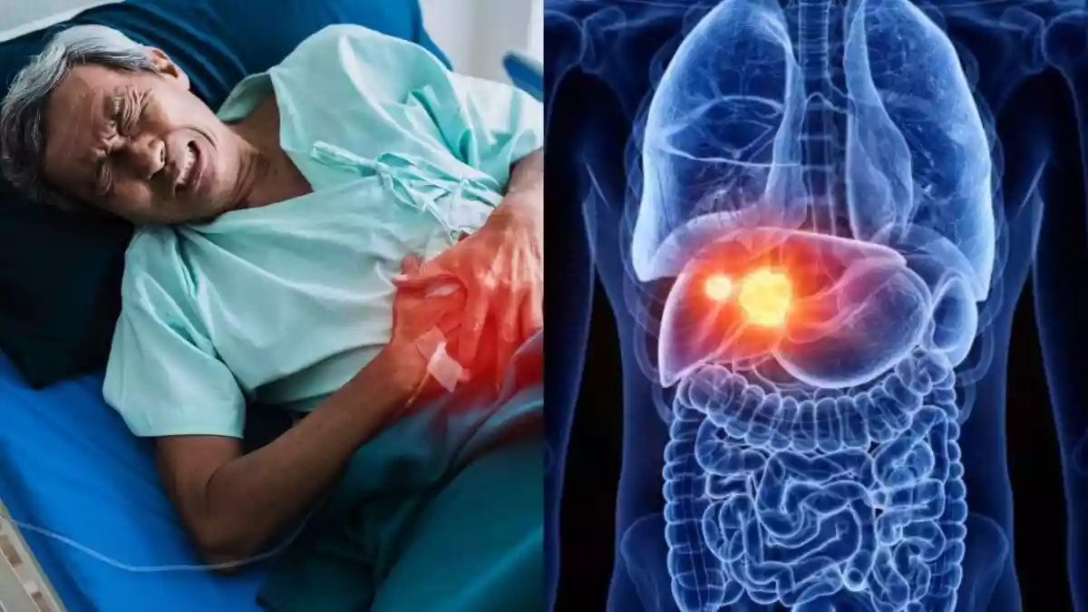 लिवर के लिए शराब की तरह खतरनाक हैं ये 5 फूड्स