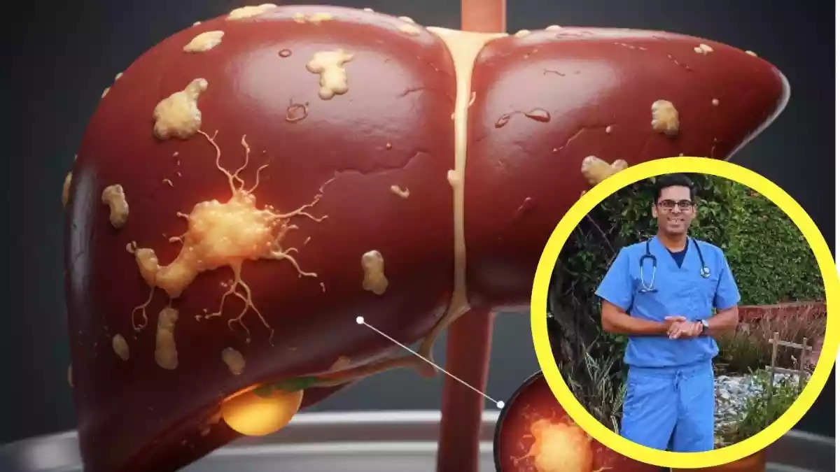 लिवर पर जमी गंदगी और फैट साफ करेंगी ये 3 चीजें