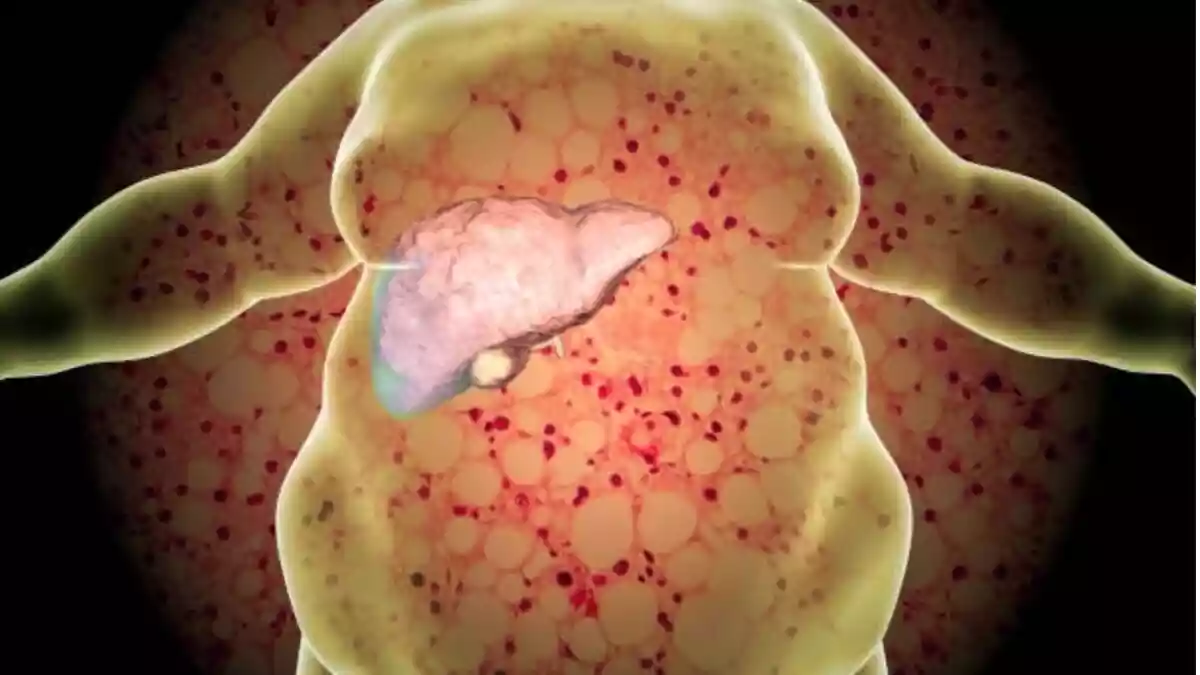 लिवर पर खतरा! हर 4 में से 1 इंसान को होगी ये बीमारी