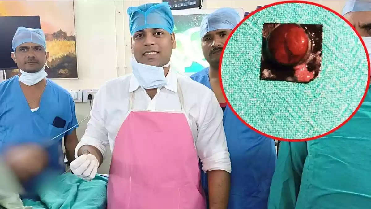 मरीज ने दवा के संग निगल लिया पूरा रैपर