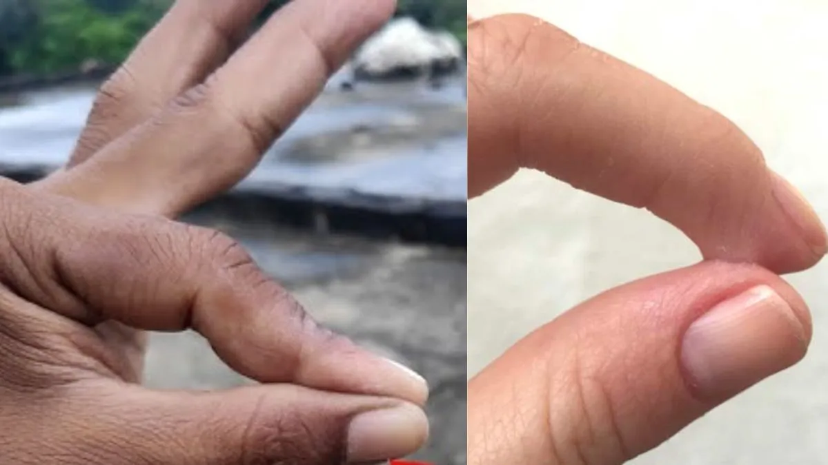 फेवीक्विक से चिपक गई हैं उंगलियां