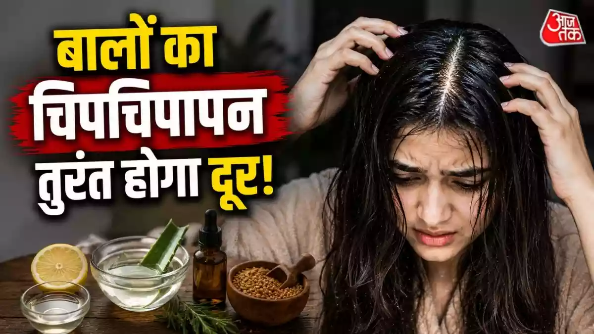 शैंपू के बाद भी बाल रहते हैं चिपचिपे