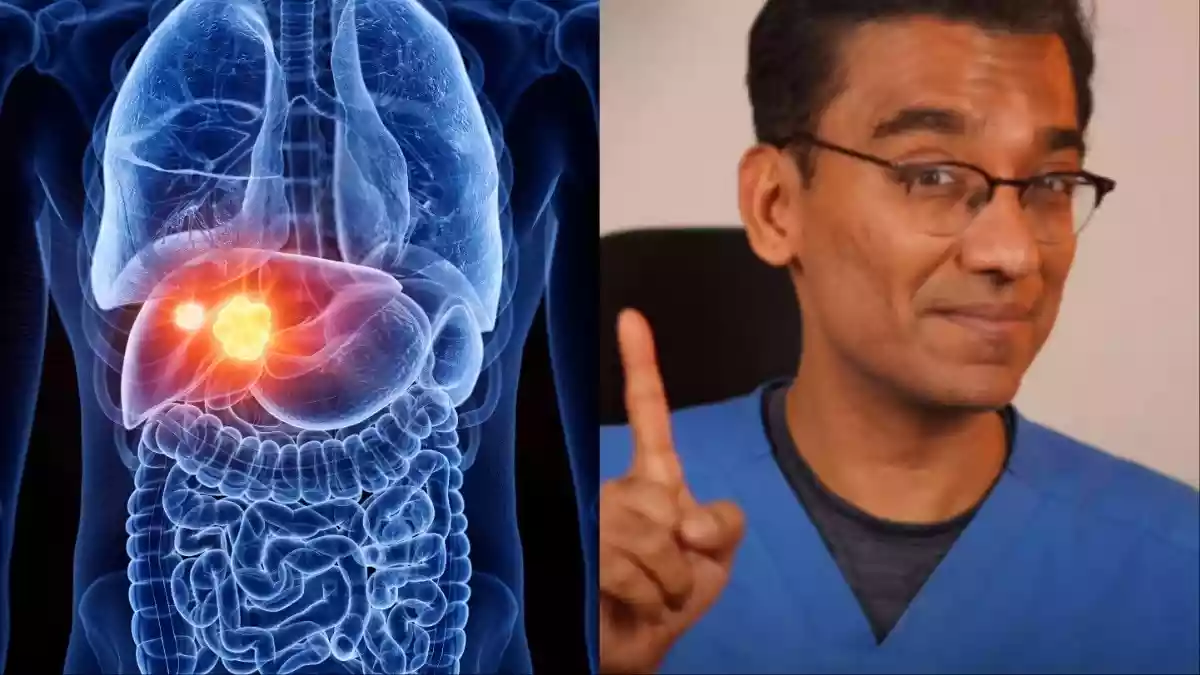 शराब न पीने वालों का लिवर भी क्यों हो रहा है खराब